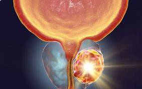 Prostadine Maintain a Healthy Prostate